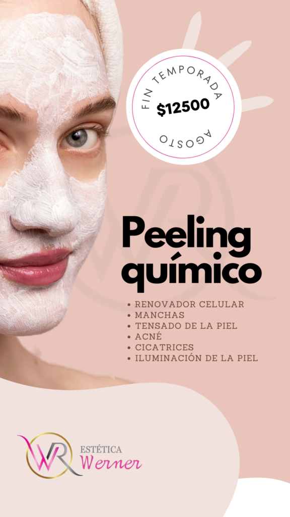 Peeling químico